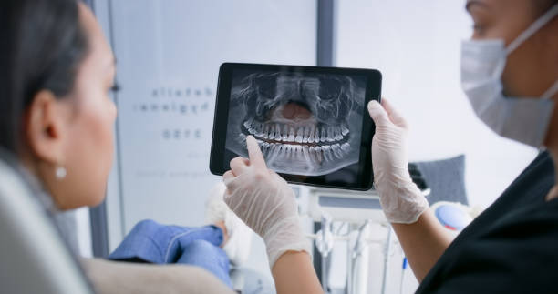 Licensed Tooth Extraction service in Lisbon, ND - Smile Center Dentistry